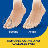 Dr. Scholl's Liquid Corn & Callus Remover, 0.33 Ounce // Removes Corns & Calluses Fast with Cushions That Provide Protection Against Shoe Pressure and Friction for All-Day Pain Relief