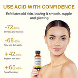 Professional Chemical Peel for Face, 50% Citric Acid Peeling Serum, Peeling Solution, Chemical Exfolianting Facial Peel for Dark Skin, Dark Spots, Acne, Wrinkle - 30ml/1 Fl oz