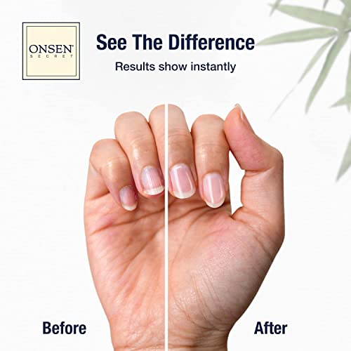 Onsen Cuticle Cream w/Nail Cuticle Oil | Cuticle Softener with Japanese Natural Healing Minerals | Nail Care Serum to Soothe, Repair & Strengthen Cuticles and Nails | Visible Results (2 Count /15 ml)