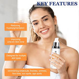 Dark Spot Corrector, Dark Spot Remover For Face and Body Serum | Improves Hyperpigmentation, Facial Freckles, Melasma, Brown Spots