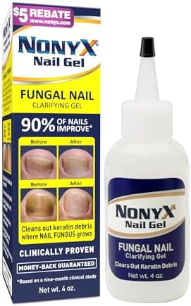 NONYX Fungal Nail Clarifying Gel | Rids Nails of Fungus by Removing Keratin Debris Where Nail Fungus Grows | 90% of Toenails Improved Using this Toenail Fungus Treatment | 4 oz