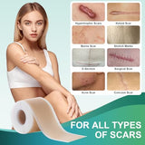 Medical Grade Silicone Scar Sheets, Silicone Scar Tape (1.6”x 120”), Professional Scar Removal Treatment, Reusable Silicone Scar Strip for Keloid, C-Section, Surgery, Burns, Acne Etc