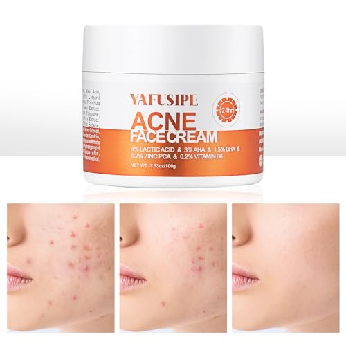 Acne Treatment for Face for Hormonal Cystic Stubborn Acne Cream for Sensitive Skin Teens Adults Women Men Spot Pimple Butt Control Rapid Clearing Breakout Overnight