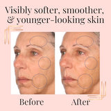 SkinInfusion Facial Oil - Anti-Aging Collagen Serum with Hyaluronic Acid - Moisturizing Matrixyl 3000 Serum with Vitamin C Oil - Hydrating Skin Oil & Serum for Dark Spots & Dull Dry Skin - 150ml