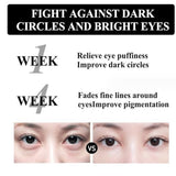 GNAUSA Berbax Eye Cream, Firming Eye Cream, Temporary Eye Tightener, Firm Eye Tightener, Eye Tightener Cream, Nuclei Firm Under Eye Firming