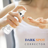 Dark Spot Corrector, Dark Spot Remover For Face and Body Serum | Improves Hyperpigmentation, Facial Freckles, Melasma, Brown Spots