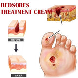 Bedsore Repair Creams,Bedsore Wound Care,Bedsore Cream,Pressure Sore Relief Cream,Bed Sore Cream Fast Acting,Fast Wound Healing Gel 20g