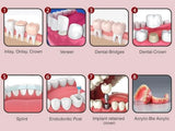 Automix Permanent Dental Cement for Caps, Crown, Bridges, Inlays, Onlays, Implants, Veneers A2