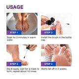 Wart Corn Removal for Feet: Salicylic Acid Plantar Wart Corn Remover Treatment for Toes Foot Fingers Hands