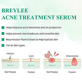 Tea Tree Oil Acne Serum, BREYLEE 2.0 Treatment Acne Prone Sensitive Skin Care Face Serum to Cystic Acne Scars, Redness Relief, Pimples Dark Spots Remove, Niacinamide Facial Moisturizer,30ml/1.01fl oz