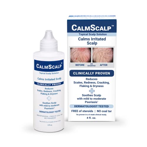 Topical Scalp Solution | Calms Irritated Scalp | Controls Dry Scalp & Flakes | Reduces Scales & Redness | Clinically Proven | Non Shampoo Leave-On Scalp Treatment | Made in The USA | 4 oz.
