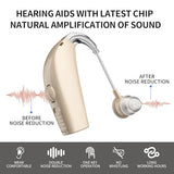 Hearing Aids Hearing Amplifiers for Seniors Rechargeable with Noise Cancelling-Hearing Aid Loss Amplifier Seniors&Adults Charging Case&Volume Control Beige (Z101)