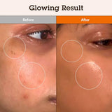 BLITHE Korean Niacinamide Serum Dark Spot Corrector Face Brightening Serum - Vitamin B3 Niacinamide Serum for Face, Skin Soothing Cica & Allantoin, Arbutin & Tranexamic Acid, 1oz