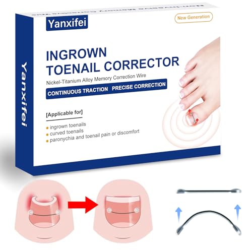 Nitinol Ingrown Toenail Corrector,at Home Ingrown Toenail Treatment,Curved Toenail Straightener,Ingrown Toe Nail Relief，Ingrown Toenail Removal Kit (11/16 In,13/16 In)