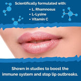 Cold Sore Treatment for Lips - Lysine Supercharged with Acidophilus Probiotic & Lactobacillus Rhamnosus + Vitamin C for Lip and Skin Health - Immune Support for Effective Prevention and Clear Skin