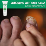 Toenail Soft Temporary Nail Softening Cream for Thick, Hard Toenails with Aloe 1 Oz (2-Pack)