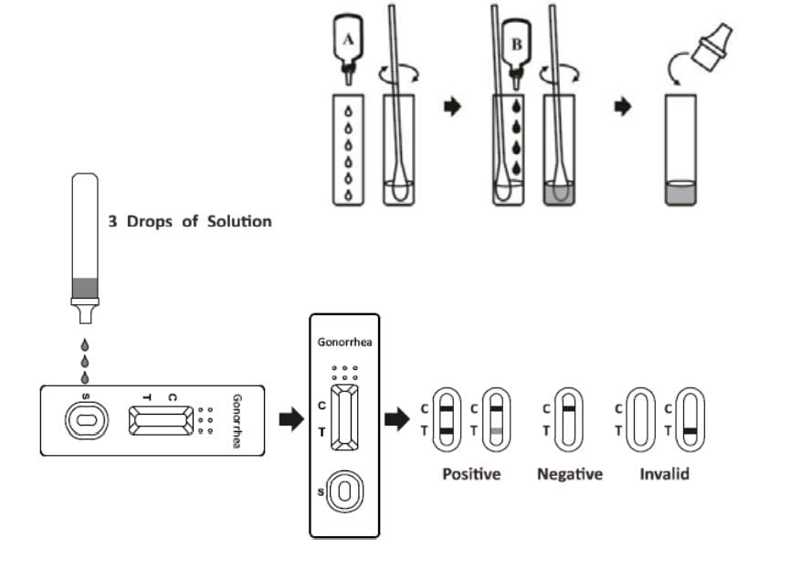 Gonorrhea Test (Male or Female) Pro GP Swab Tests STI STD Kit Test CE