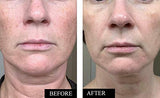 Organic Vitamin C Serum for Face with Hyaluronic Acid - Best Anti Wrinkle Facial Serum to Reduce Wrinkles, Dark Spots & Sun Damage - Anti Aging Brightening Vitamin C Face Serum for Women & Men -1.7 Oz