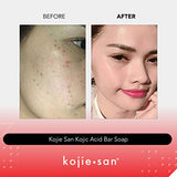 Kojie San Skin Brightening Soap - Original Kojic Acid Soap that Reduces Dark Spots, Hyperpigmentation, & Scars with Coconut & Tea Tree Oil- 135g x 4 Bars