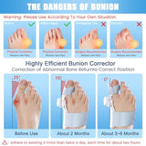 Gkaikpe Bunion Corrector for Women & Men,Adjustable Knob Bunion Corrector for Women Big Toe,Bunion Splint for Bunion Relief,Orthopedic Toe Straightener Suitable for Left and Right Feet
