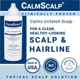 CalmScalp Topical Solution for Symptoms of Mild to Moderate Psoriasis | Irritated Scalp | Hairline Scales | Redness | Dry Scalp | Made in The USA | 4 oz.