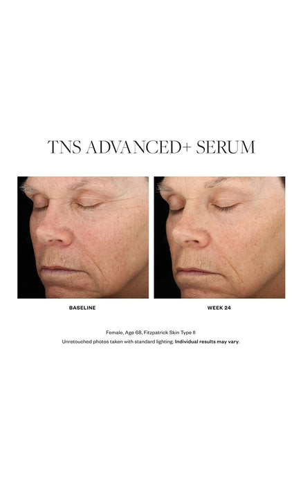 SkinMedica TNS Advanced+ Serum - Our Premium Facial Skin Care Product, the Secret to Flawless Skin. Age-Defying Face Serum for Women is Proven to Address Wrinkles and Fine Lines for Glowing Skin,1 Oz