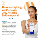 AcneFree Adapalene Gel 0.1%, Once-Daily Topical Retinoid Acne Treatment, Dermatologist Developed, Unclogs Pores and Clears Acne, Prevents and Improve Whiteheads and Blackheads, 1.6 Ounces