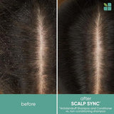 Biolage Scalp Sync Conditioner | Weightlessly Soothes & Nourishes To Promote A Healthy-Looking Scalp | Paraben Free | For All Hair Types | Cruelty Free | Vegan | Salon Conditioner | 13.5 Fl. Oz