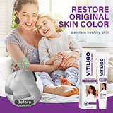 Vitiligo Cream, Vitiligo Treatment Cream, Vitiligo Cream for Skin Healthy Care