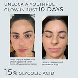 INSTASKINCARE Glycolic Acid Serum for Face 15% Strength - Extra Large Size (2Oz) - Advanced Formula for Enhancing Skin Radiance, Texture Improvement, Addressing Uneven Tone & Fine Lines by InstaSkincare