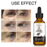 Caffeine Eye Serum - with EGCG, Vitamin C, Hyaluronic Acid, Collagen, Caffeine Eye Lift Serum - Reduces Puffiness, Dark Circles, Under Eye Bags, Wrinkles and Fine Lines Around The Eyes (60ml)