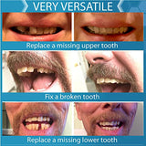 INSTANT SMILE Complete Your Smile Temporary Tooth Replacement Kit - Replace a Missing Tooth in Minutes - Patented