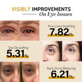 CITYGOO Eye Cream For Dark Circles: Eye Puffiness Under Eye Bags Treatment - Anti-Wrinkle Snail Eye Stick