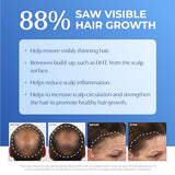 BosleyMD BosRevive KIT for Visible Hair Thinning (Non Color-Treated), Starter Size (30 Days)