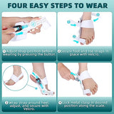 Kutain Upgraded Bunion Corrector for Women & Men, Orthopedic Bunions Correction with Non-Slip Big Toe Separators, Adjustable Bunion Splint Suitable for Left/Right Feet Bunion Relief (1PCS)