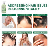 Svvimer Rosemary Hair Growth Shampoo: Thickening and Regrowth Formula for Men & Women - Rosemary Mint Strengthening Shampoo with Tea Tree Oil Biotin - For Thinning Hair and Hair Loss 11.8 fl.oz