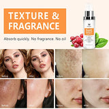 Dark Spot Corrector, Dark Spot Remover For Face and Body Serum | Improves Hyperpigmentation, Facial Freckles, Melasma, Brown Spots