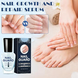 2Pcs Onyxoguard Nail Growth And Repair Serum, Onyx Guard Nail, Onyxoguard Serum, Nail Strengthener For Thin Nails And Growth