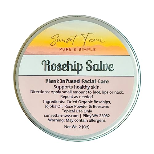 Rosehip Salve Herbal Balm Skin Body Care Ointment 2 oz