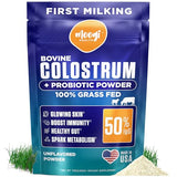 Bovine Colostrum Supplement for Humans - Gut Health, Skin Care, Hair Growth & Immune Support Supplement - 50% IgG Grass Fed Colostrum Powder with Probiotics for Women & Men - Unflavored (30 Servings)