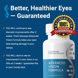Advanced Bionutritionals – Advanced Vision Formula Supplement, Healthy Vision, Eye Function Support, Eye Vitamins, Lutein, Zeaxanthin, Vitamin A, C, Zinc, Gluten Free, Dairy Free, Vegan (60 Tablets)