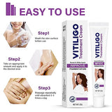 Vitiligo Cream, Vitiligo Treatment Cream, Vitiligo Cream for Skin Healthy Care