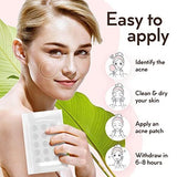 LE GUSHE K-BEAUTY Pimple Patches for Face (132 dots) - Hydrocolloid Acne Patch for Zits and Blemishes - Invisible Blemish Patches | Spot Cover Stickers for Glowing Skin | Korean Skin Care