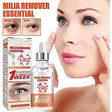 TGMALL DermaPRO Speedy Milia Remover,Milia Remover Milia Spot Treatment Helps Dissolve and Reduce Milia,Facial Treatments for Eyelid Milia, Acne, Blemish, Pimple, Whitehead, Cysts. (2pcs)-2-PCS