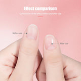 Radiant Nail Growth Oil, 2024 New Cosmetics Nail Growth Oil Radiant Nail Growth Oil Pen, Upgraded Cuticle Oil for Nails Strengthener for Moisture Strengthen Brighten Nails Care (Lily 4PCS)