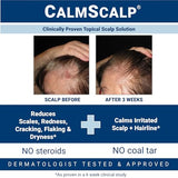 CalmScalp Topical Solution for Symptoms of Mild to Moderate Psoriasis | Irritated Scalp | Hairline Scales | Redness | Dry Scalp | Made in The USA | 4 oz.