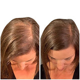 THICK FIBER Hair Fibers for Thinning Hair & Bald Spots (MEDIUM BROWN) - 25g Bottle - Conceals Hair Loss in Seconds - Hair Powder For Women & Men
