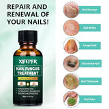 XIFEPFR Toenail Repair Treatment Extra Strength, Toenail Fûngus Treatment for Toenail and Fingernail, Nail Care Renewal Liquid for Thick Brittle Damaged Discolored Nails, Restoring Healthy Nails