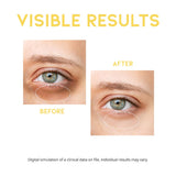 Dark Circle Remover Eye Serum, Eye Bags Treatment for Men and Women, Vitamin C, Niacinamide, Ceramide, Vegan Under Eye Treatment 30g