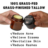 Beef Tallow Honey Balm - Grass-Fed Organic Face Cream with Honey & Olive Oil, for Eczema, Rosacea, Baby, Acne (4 oz)